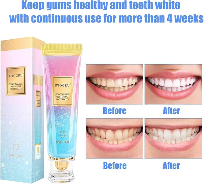 Niacinamide Whitening Toothpaste, Utogru Teeth Radiant Whitening Toothpaste - Enamel Care, Repair and Protect Teeth, Fresh Breath (1)