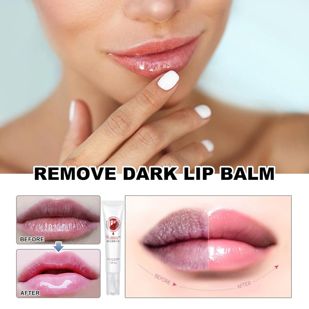XIRUJNFD Lip Serum, Remove Dark Lips Pink Fresh Lightening Lips Treatment Lip Balm, Moisturizer Nourishing Essence Lips (1)