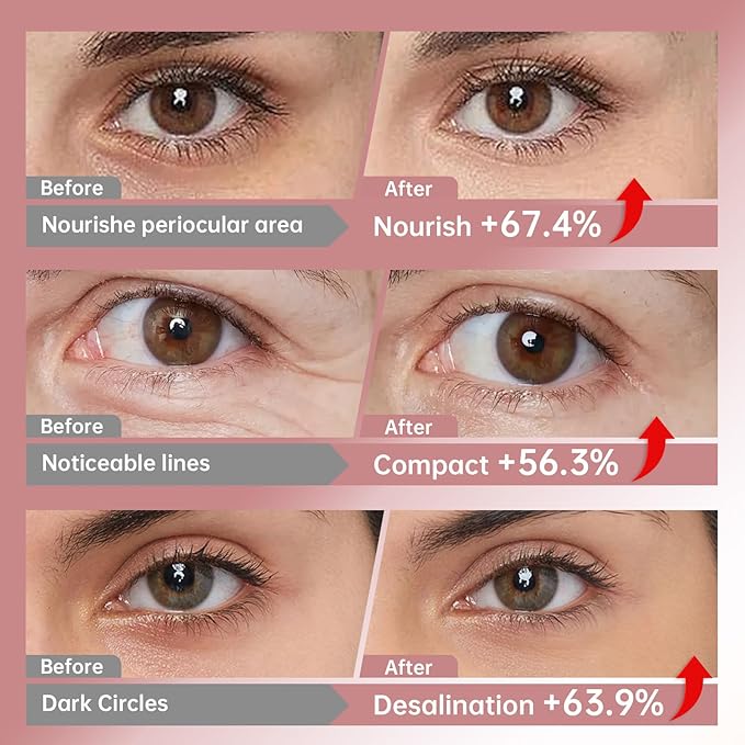 15 Pairs 3-Secs Melting Collagen Under Eye Patches with Vitamin C Serum, Under Eye Mask for Puffy eyes and Dark Circles | Retinol+Hyaluronic+Niacinamide+Ceramides,Korean Popular Eye Patches