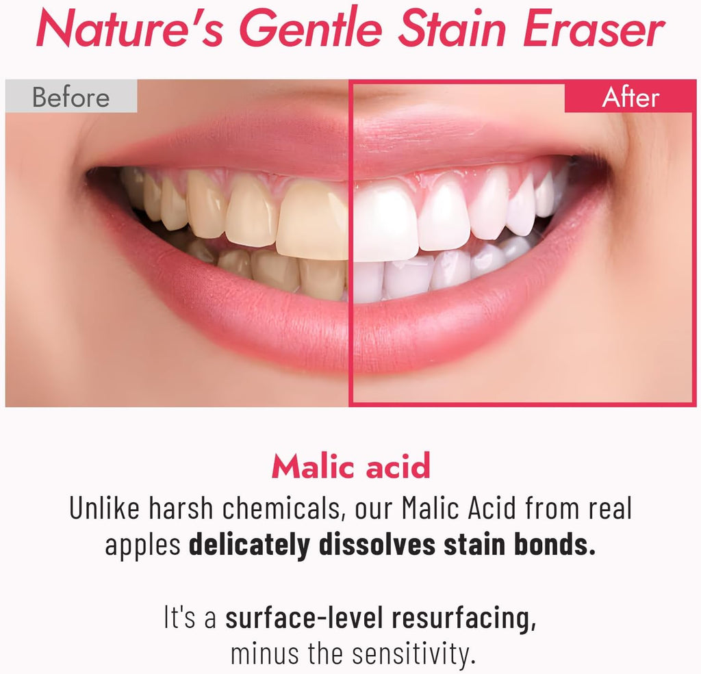MALIC Acid Teeth Whitening Toothpaste,Natural Care Deep Stain Removal&Plaque,Fluoride Free,Non Toxic,for Adults, Kids and Sensitive Teeth，with Niacinamide，3.57oz.