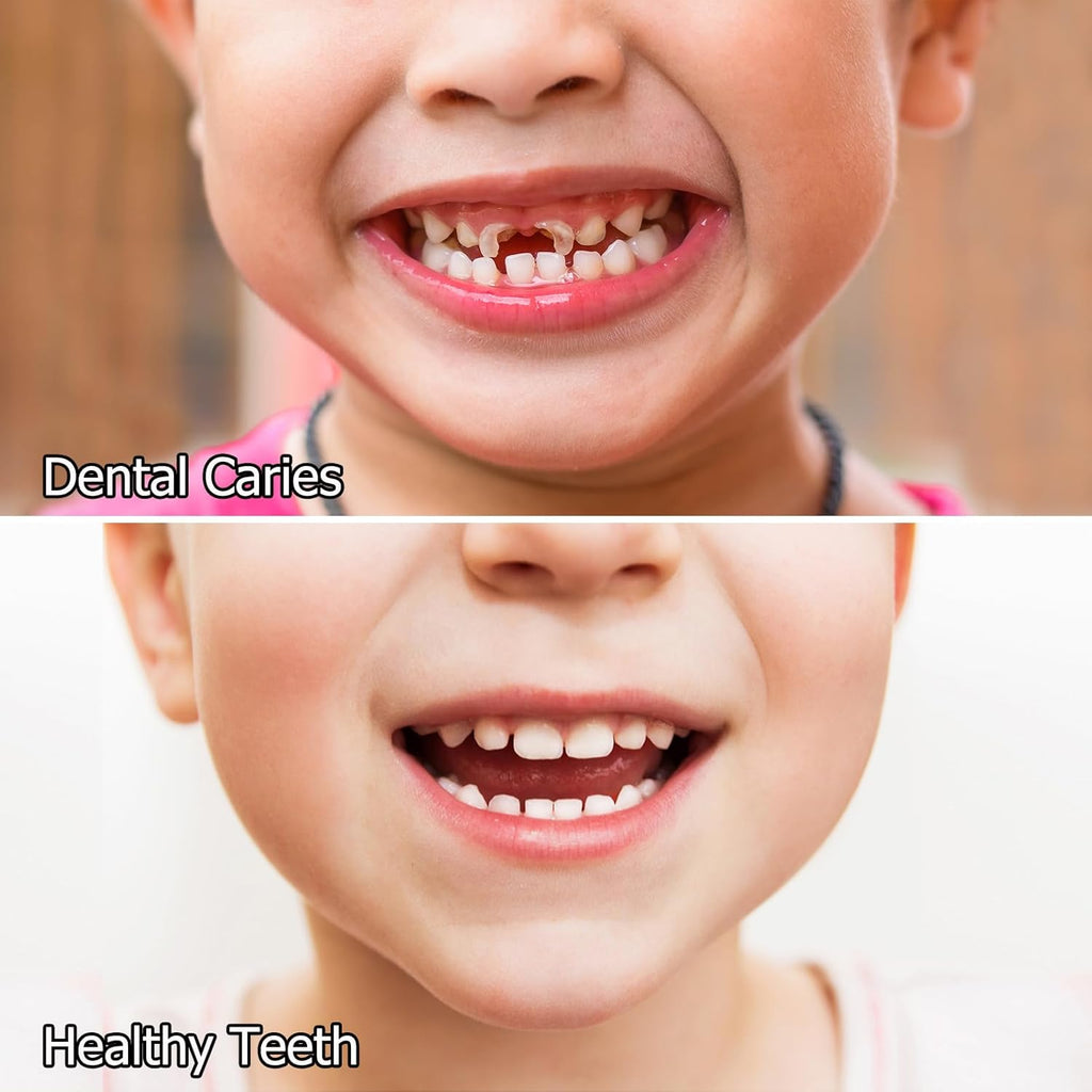 Kids Oral Spray, Toddler Toothpaste Helper for Cavity Prevention and Fresh Breath, Children Anticavity with Fluoride Free for Newborn to Preschoolers, Kid's Mouth Spray (1)