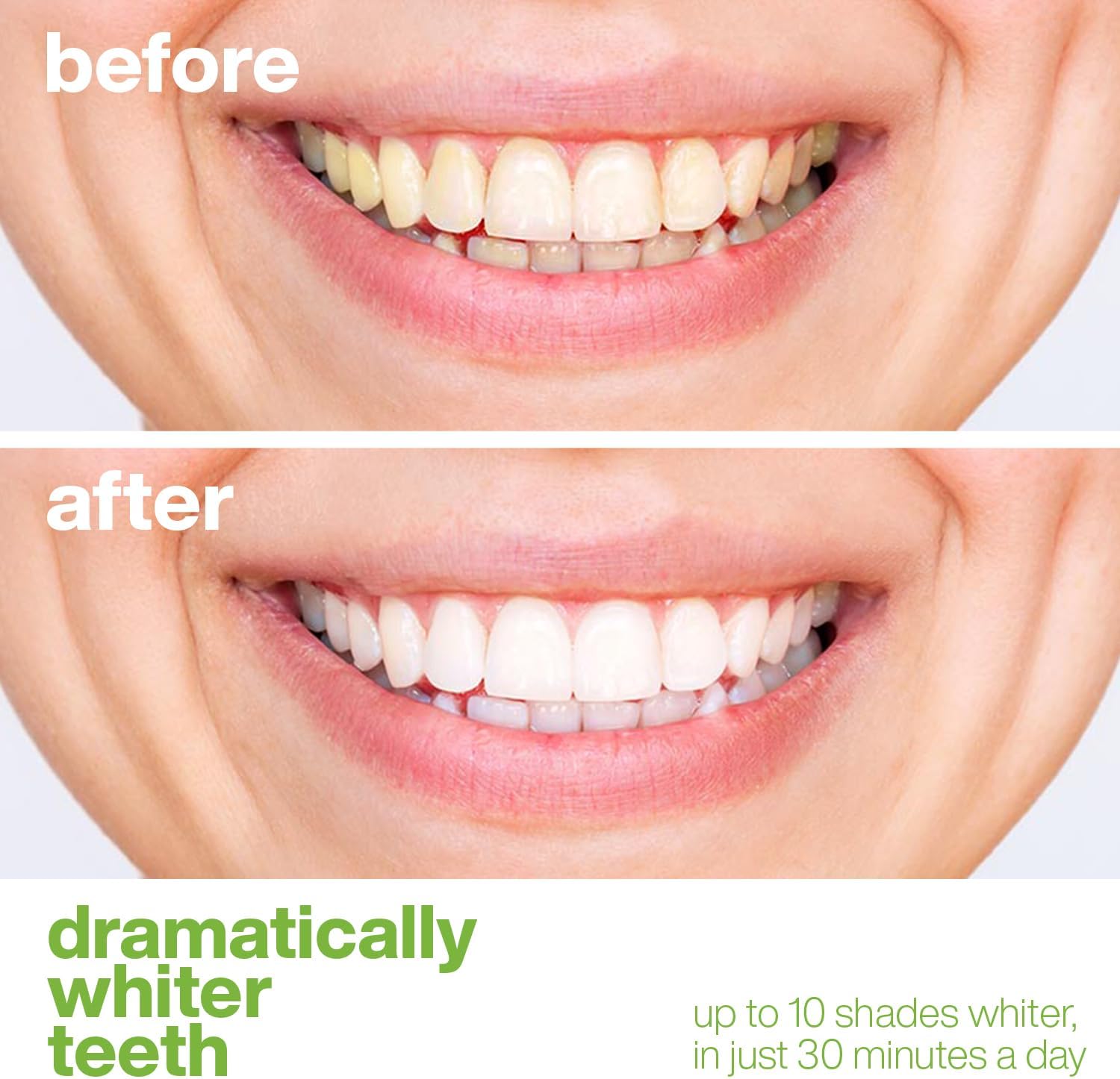 AquaSonic Professional Teeth Whitening Strips - Enamel Safe Teeth Whitening with Hydrogen Peroxide - Easy to Use, Non-Slip, Affordable & Effective (Spearmint)