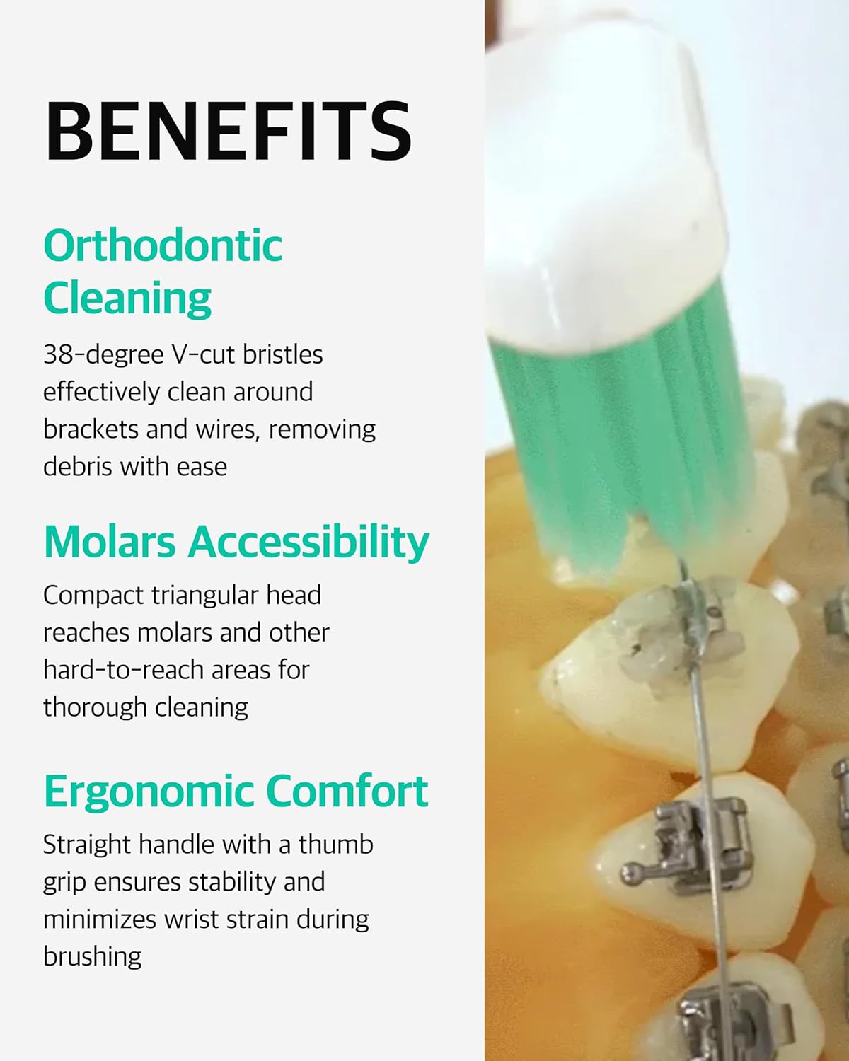V-Cut Orthodontic Toothbrush (Mint 3 Units + White 3 Units) - Compact Head for Braces, Ergonomic Handle, Deep Cleaning, Gentle Bristles for Brackets and Wires