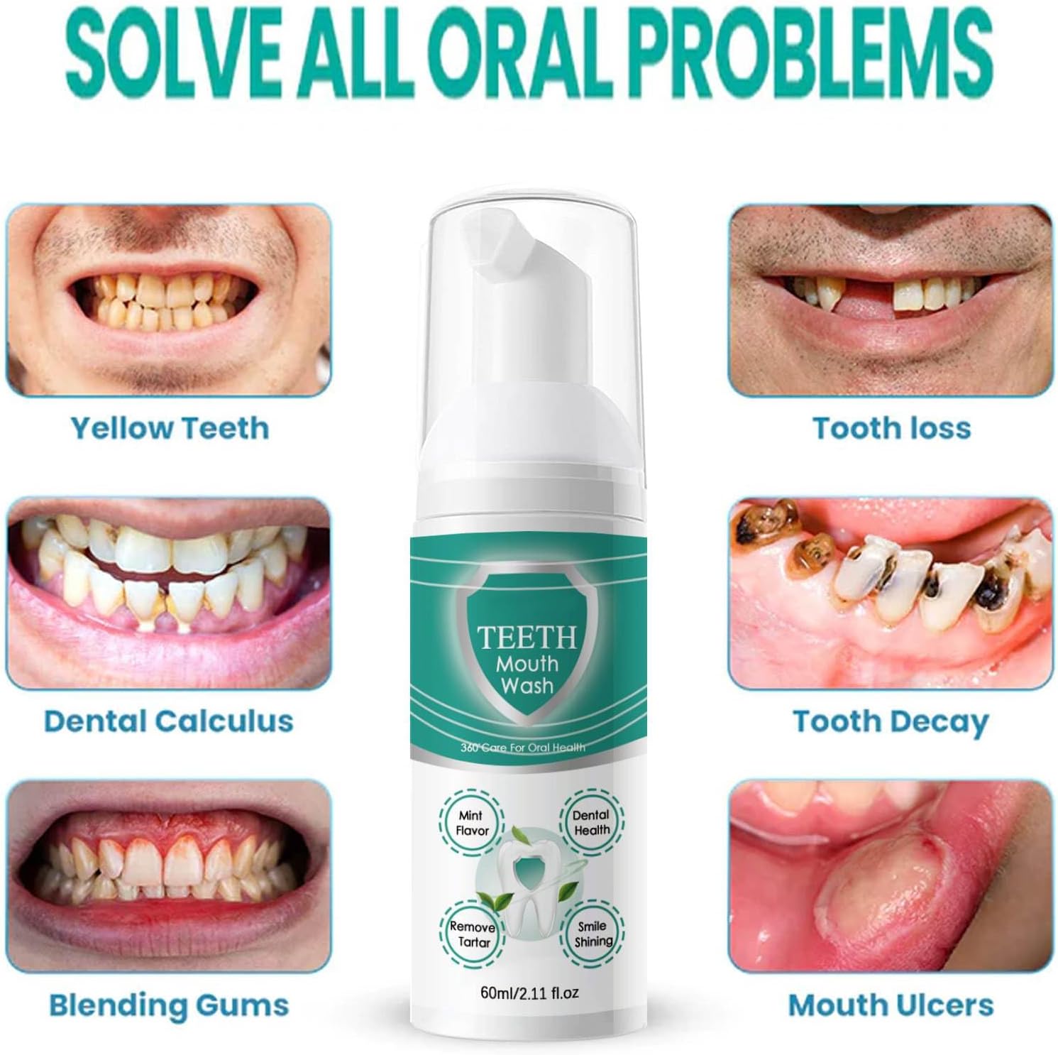 Teeth Total Care Mouthwash,Ultra-Fine Herbal Teeth Mouthwash Foam,Mint Taste Repair Toothpaste for Sensitive Teeth,Refreshing Breath,Clean Tooth & Gums Deeply,Solve All Oral Problems (2pc)