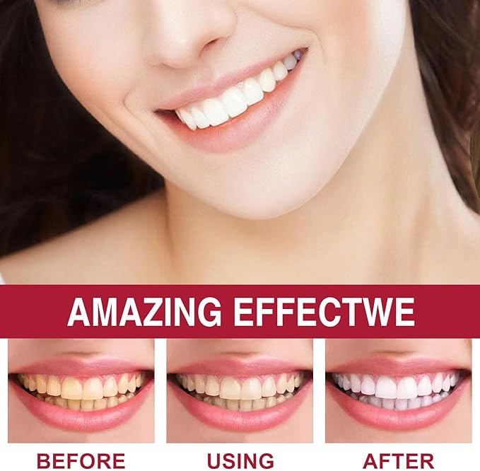 2 Pcs Sp-6 Probiotic Ultra Whitening Toothpaste, Sp 6 Toothpaste, Deep Cleaning Care, Stain Removing, Fresh Breath.