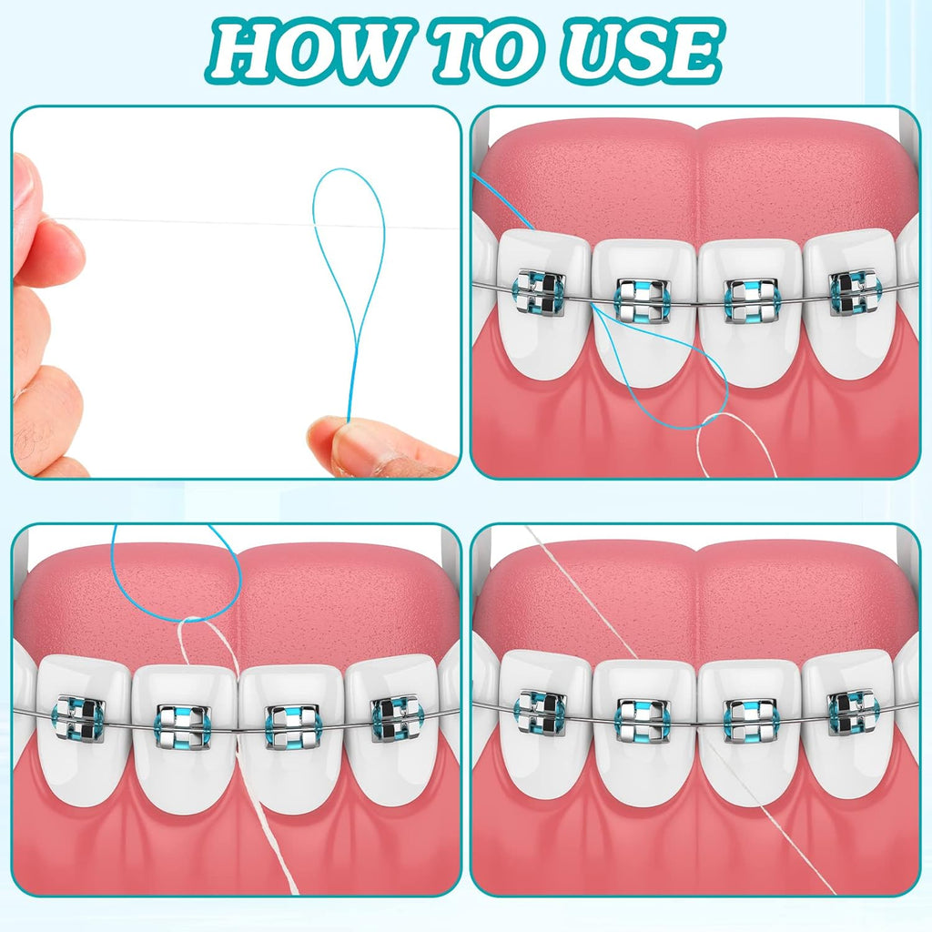 1000 Pcs Dental Floss Threaders Deep Clean Floss for Braces, Bridges, and Implants, Multifunctional Nylon Loop Design for Your Teeth, Pack of 20(Blue)