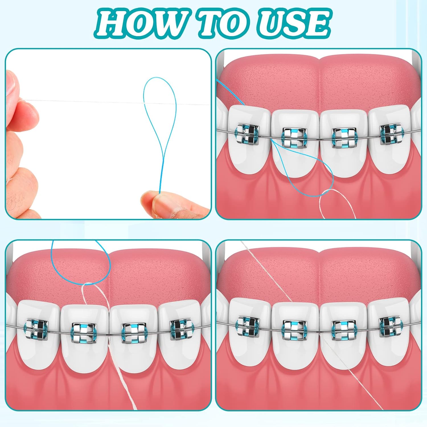 1000 Pcs Dental Floss Threaders Deep Clean Floss for Braces, Bridges, and Implants, Multifunctional Nylon Loop Design for Your Teeth, Pack of 20(Blue)