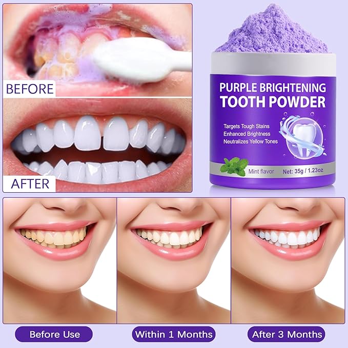 2PCS Teeth Whitening Powder, Removes Stains, Teeth Whitening, Toothpaste Whitening Powder for Coffee, Tea, Food, Wine, Keeps Breath Fresh, Promotes Oral Health,No Sensitivity