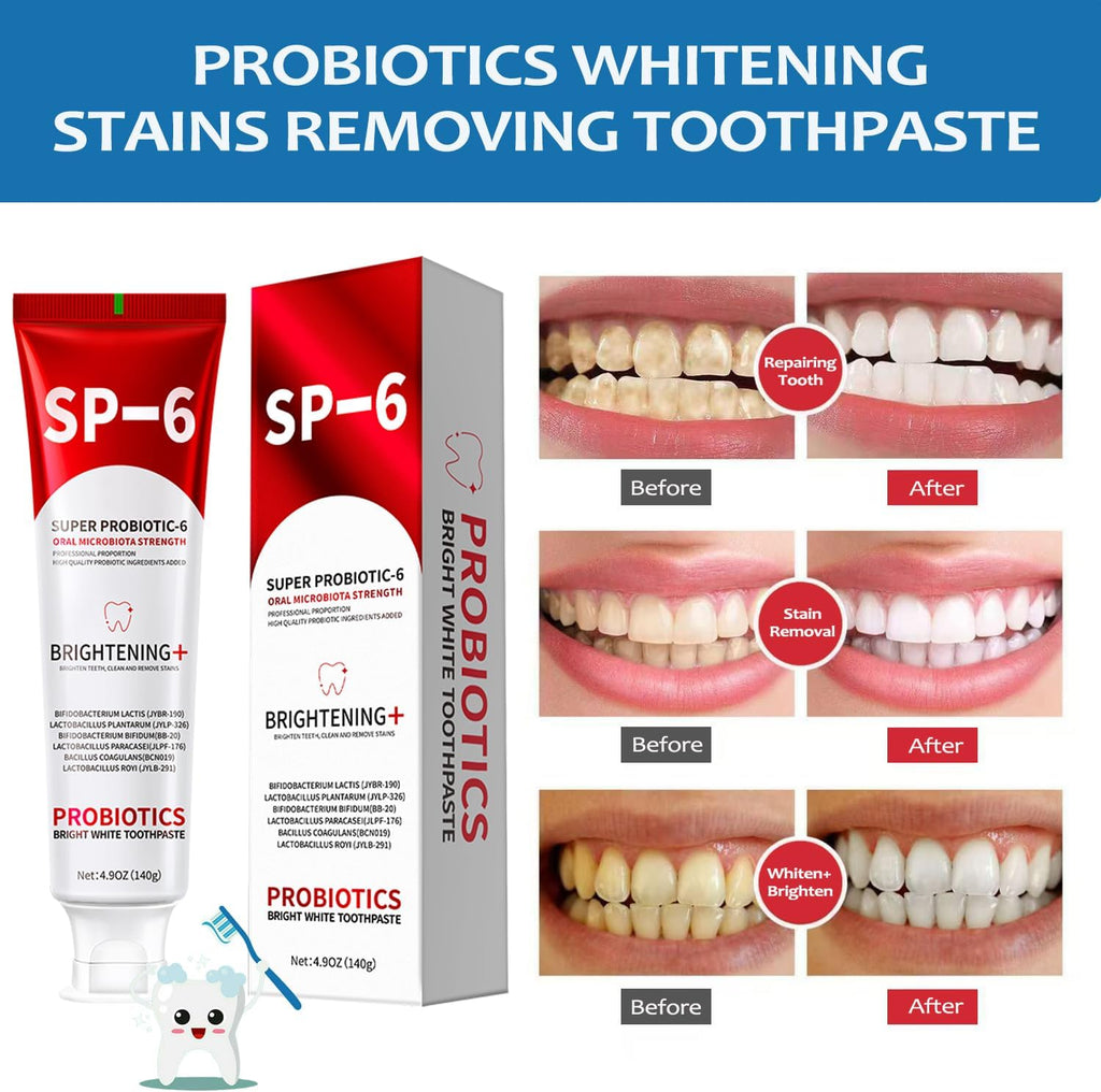 SP-6 Probiotics Whitening Toothpaste, 2 PCS 6 Probiotics Enhanced Formula Brightening Toothpastes for Teeth Whitening and Gum Health, Fluoride-Free, Fresh Breath with Mint Flavor (2 PCS)