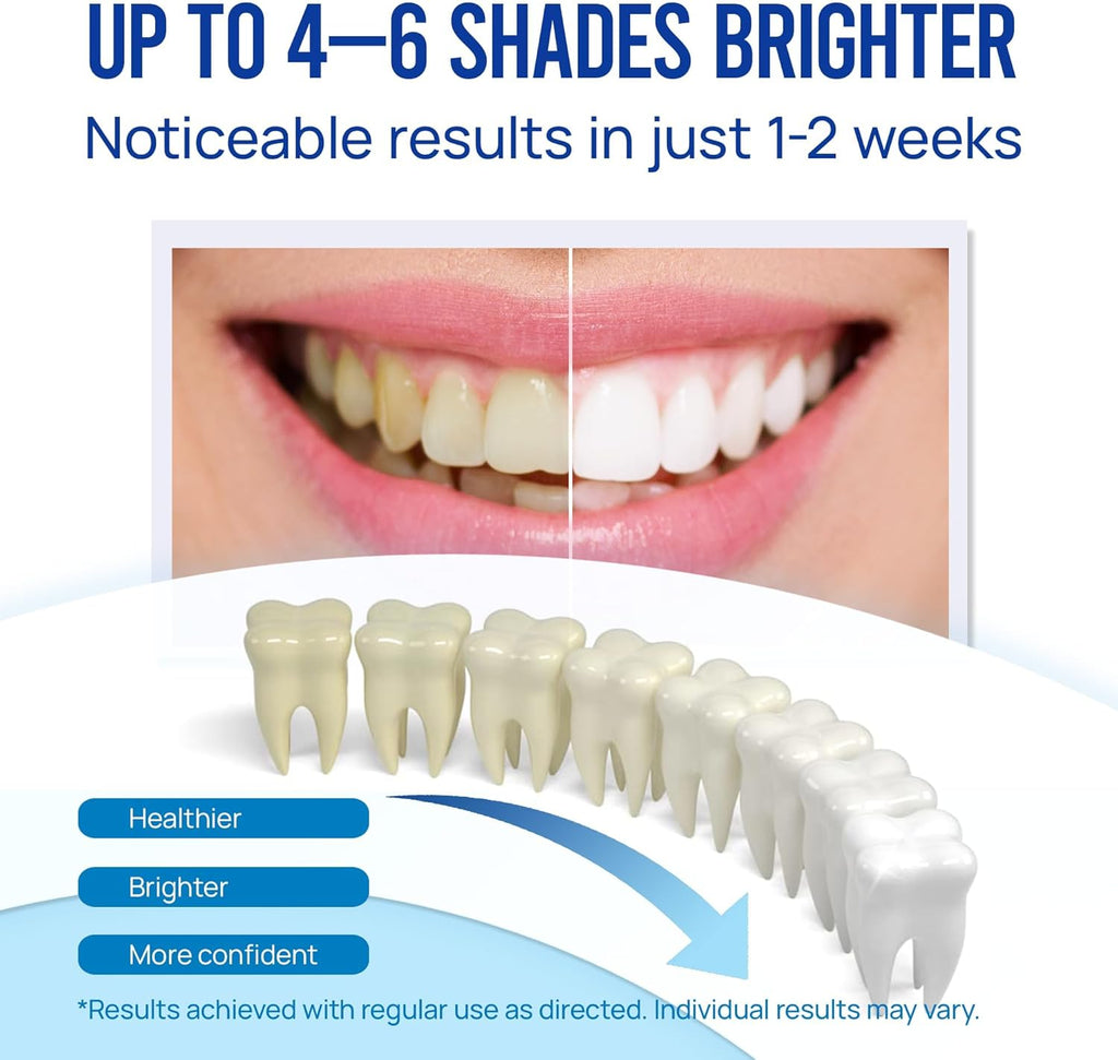 Teeth Whitening Pen Gel Kit: 35% Carbamide Peroxide Gel for Stain Removal - No Sensitivity with Remineralizing Pen for a Brighter Whiter Smile Mint (5 Pack)