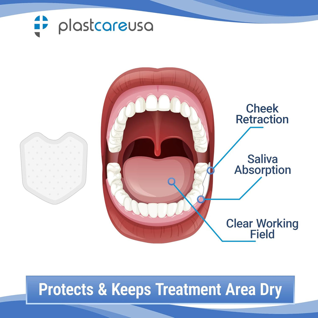 200 Dental Dry Corners, Disposable Saliva Control & Cheek Protection Pads Super Absorbent Non-Woven Padding (Cotton Roll Alternative) (Large)