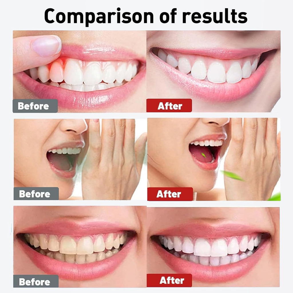 Spearmint Oil Pulling Rinse – with Organic Cold-Pressed Coconut Oil ＆ Mentha Haplocalyx Oil, Natural Mouthwash for Fresh Breath, Healthy Gums & Teeth Whitening, 8 fl oz (1)