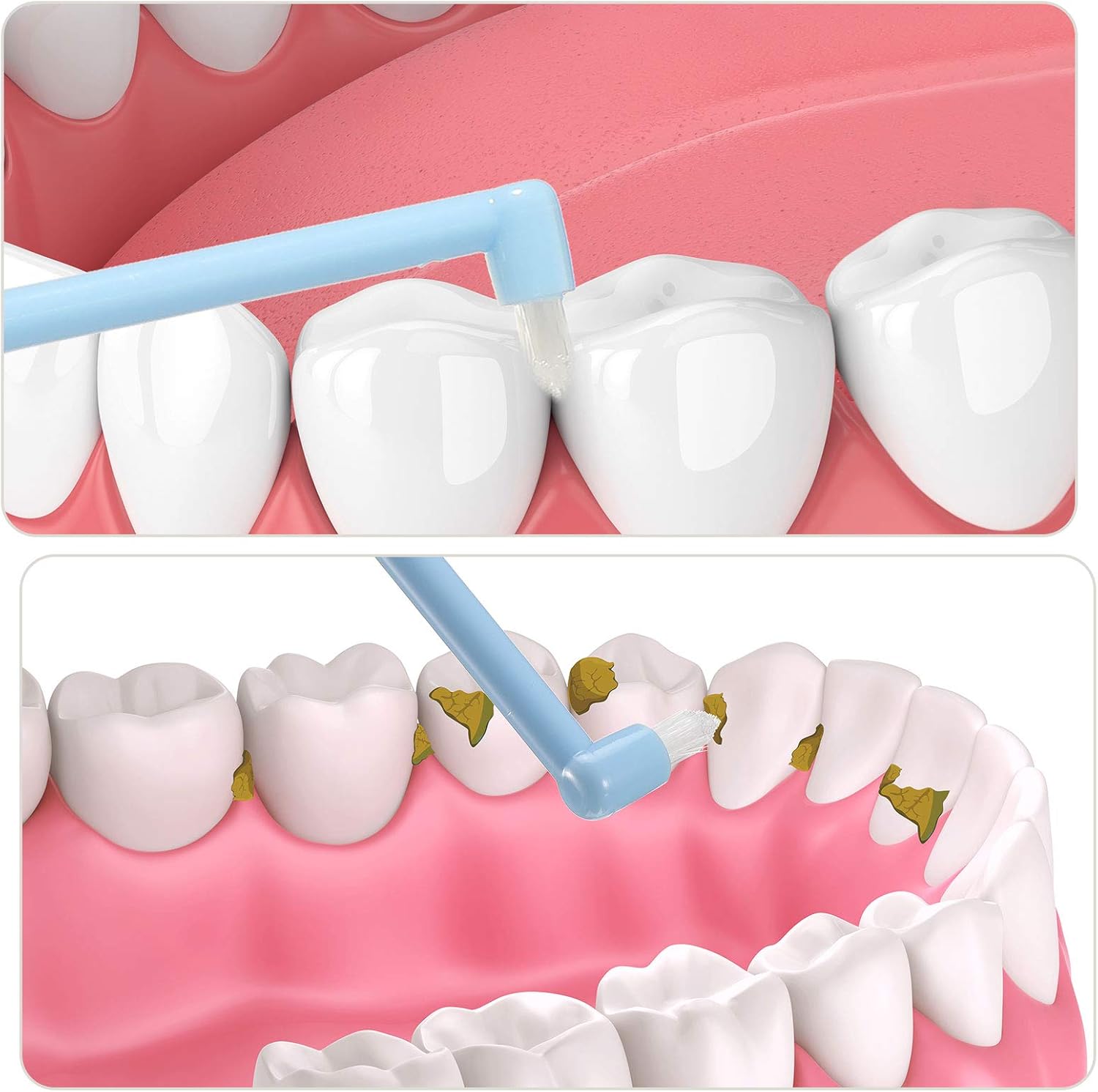 Patelai 12 Pcs End Tuft Toothbrush Soft Interdental Brushes Tooth Stain Remover Trim Toothbrush Single Brush for Implants Teeth Detail Cleaning Supplies(Orange, Rose Red, White and Blue)