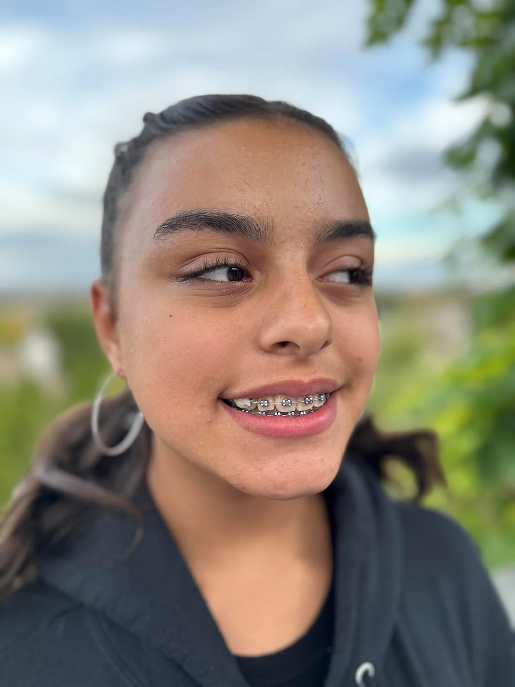 Orthodontic Wax – Original Honey, Natural Braces Protection, Long-Lasting Comfort, Pre-Cut Wax Pieces in Aluminum Travel Case (75 Buttons) - Fresh Mint