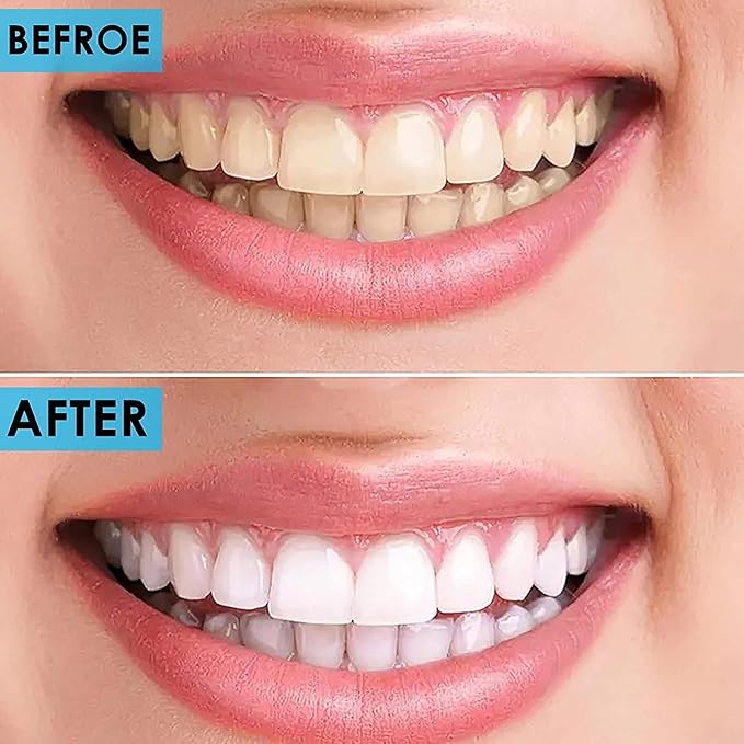 Professional Dental Tools - Dental Pick, Dental Scaler for Tartar Plaque Remover Tooth Cleaner Teeth Scraper Dentist Hygienist Kit Sickle Scaler Teeth Cleaning Set Stainless Steel 2 Pc By Krisp Beauty