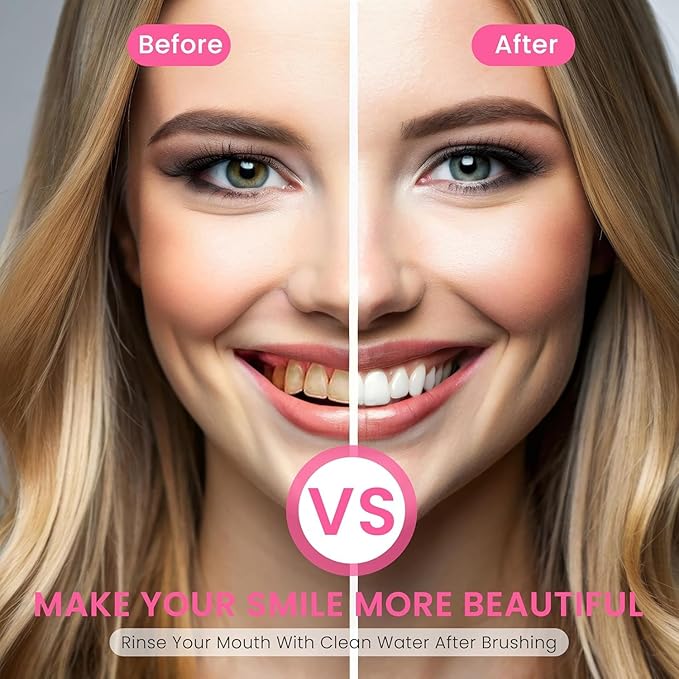 2 Pack BodyAccel Niacinamide Whitening Toothpaste, Triple Whitening Niacinamide Toothpaste, Brightens and Whitens Teeth, Natural Gentle, Fresh Breath