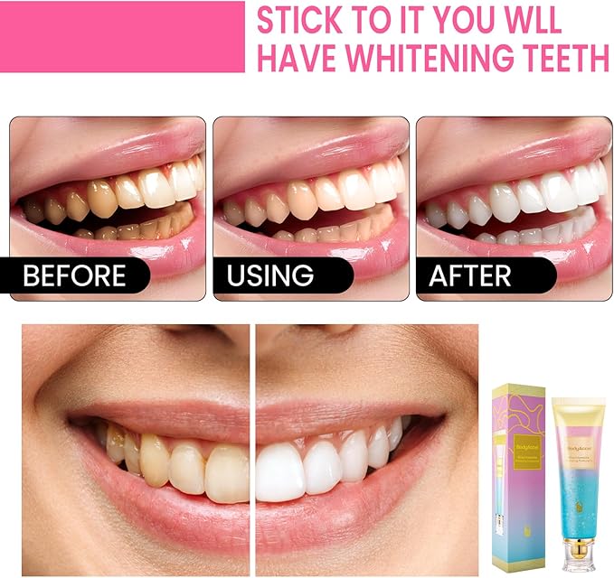 BodyAccel Niacinamide Whitening Toothpaste, Brightens and Whitens Teeth, Stain Removal Natural Gentle, Fresh Breath