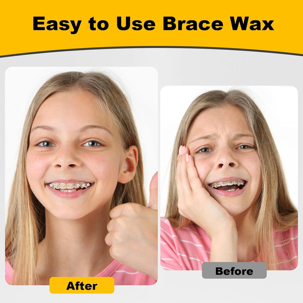 180PCS Braces Wax,Orthodontic Wax with Individual Packaging,Dental Waxs for Brace Travel Home Office,Mint