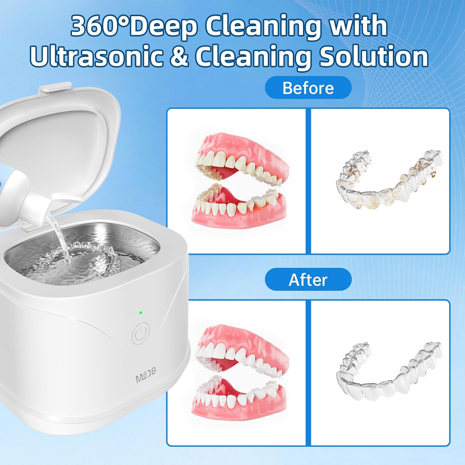 Bcom Ultrasonic Retainer Cleaner Solution, Jewelry Cleaner Solution Deep Clean for Retainer, Mouthguards, Night Guards, Aligners and Jewelry Ring, Odor Stain Remover for Ultrasonic Machines (8.5 oz)