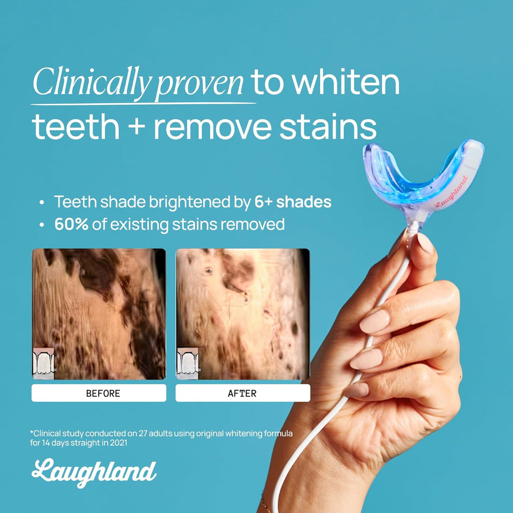 Laughland Original Teeth Whitening Kit, Phone-Powered LED Mouthpiece & 3 Whitening Gel Syringes, 8% Hydrogen Peroxide, Aloe Vera & Mint, for Sensitive Teeth, at-Home Dental Care, 6+ Treatments