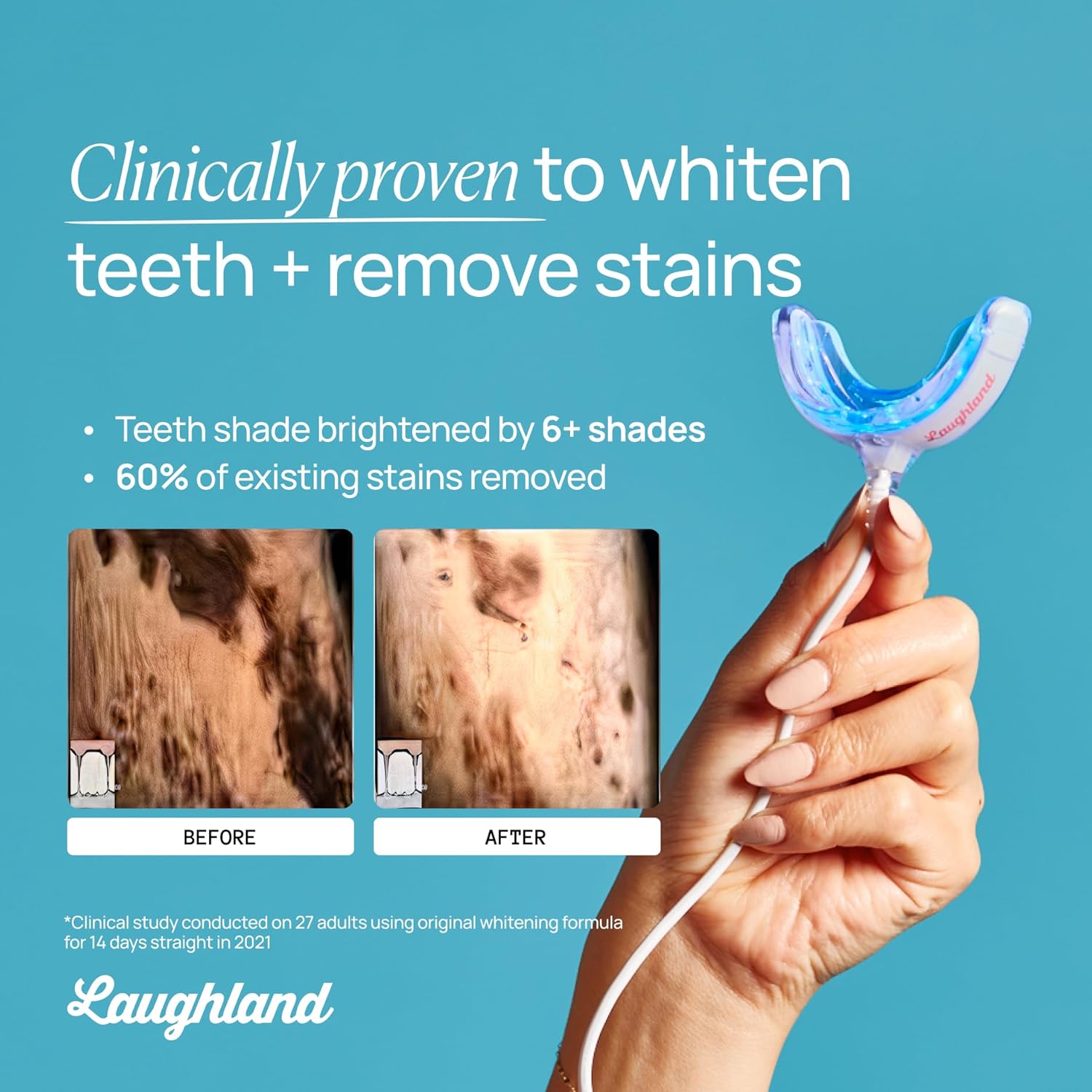 Laughland Original Teeth Whitening Kit, Phone-Powered LED Mouthpiece & 3 Whitening Gel Syringes, 8% Hydrogen Peroxide, Aloe Vera & Mint, for Sensitive Teeth, at-Home Dental Care, 6+ Treatments