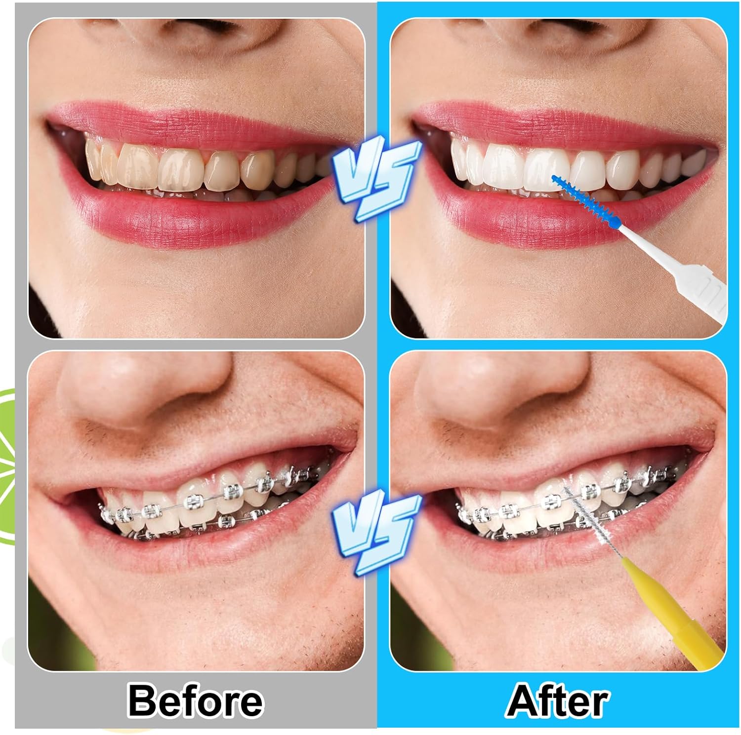 255 Pieces Braces Flossers for Braces, Interdental Brush Soft Dental Floss Picks Braces Cleaning Kit Toothpick Dental Brush Braces Teeth Flossers Brushes for Tooth Cleaner(Multiple Sizes)