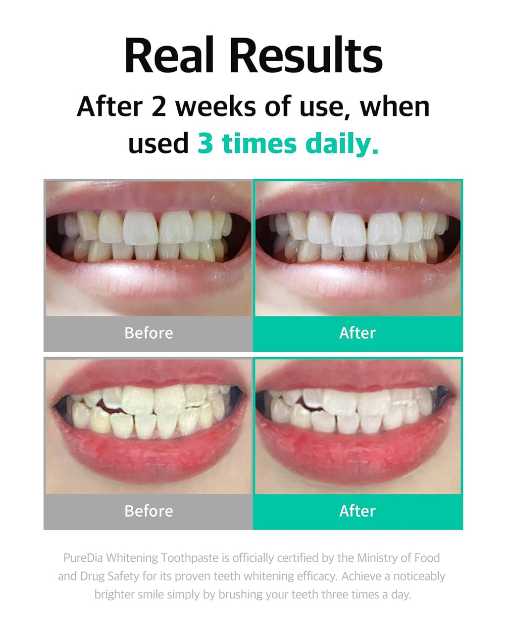 Whitening Toothpaste 80g x 3 – Fluoride-Free, Nano Hydroxyapatite & Hydrogen Peroxide, Sensitive Teeth, Enamel Strengthening, Natural Mint Gel