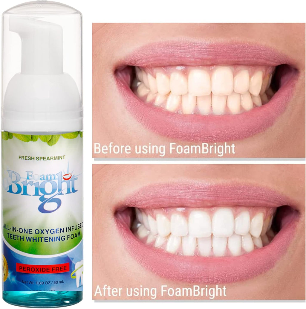 Retainer Cleaner & Aligner Cleaner FoamBright, Great for Invisalign, Teeth Whitening Foam, Candid, Byte, Denture Whitener Toothpaste & Braces Cleaning Peroxide Free Oral Care Replaces Tablets, Paste