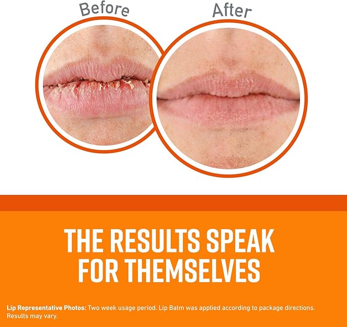 O'Keeffe's Unscented Lip Repair Lip Balm for Dry, Cracked Lips, Stick, (Pack of 4)