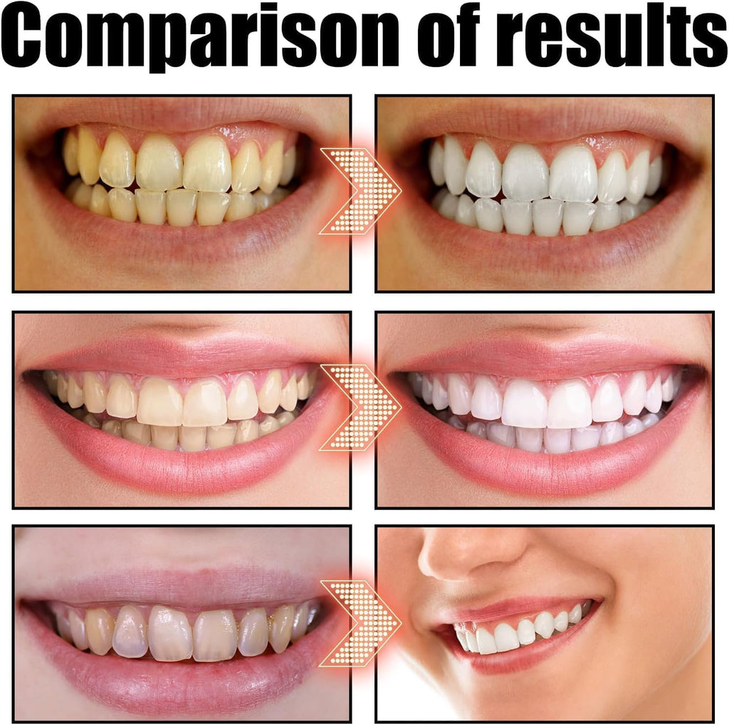 Spearmint Oil Pulling Mouthwash – Cold-Pressed Coconut Oil for Teeth Whitening, Fresh Breath & Oral Detox, 8oz