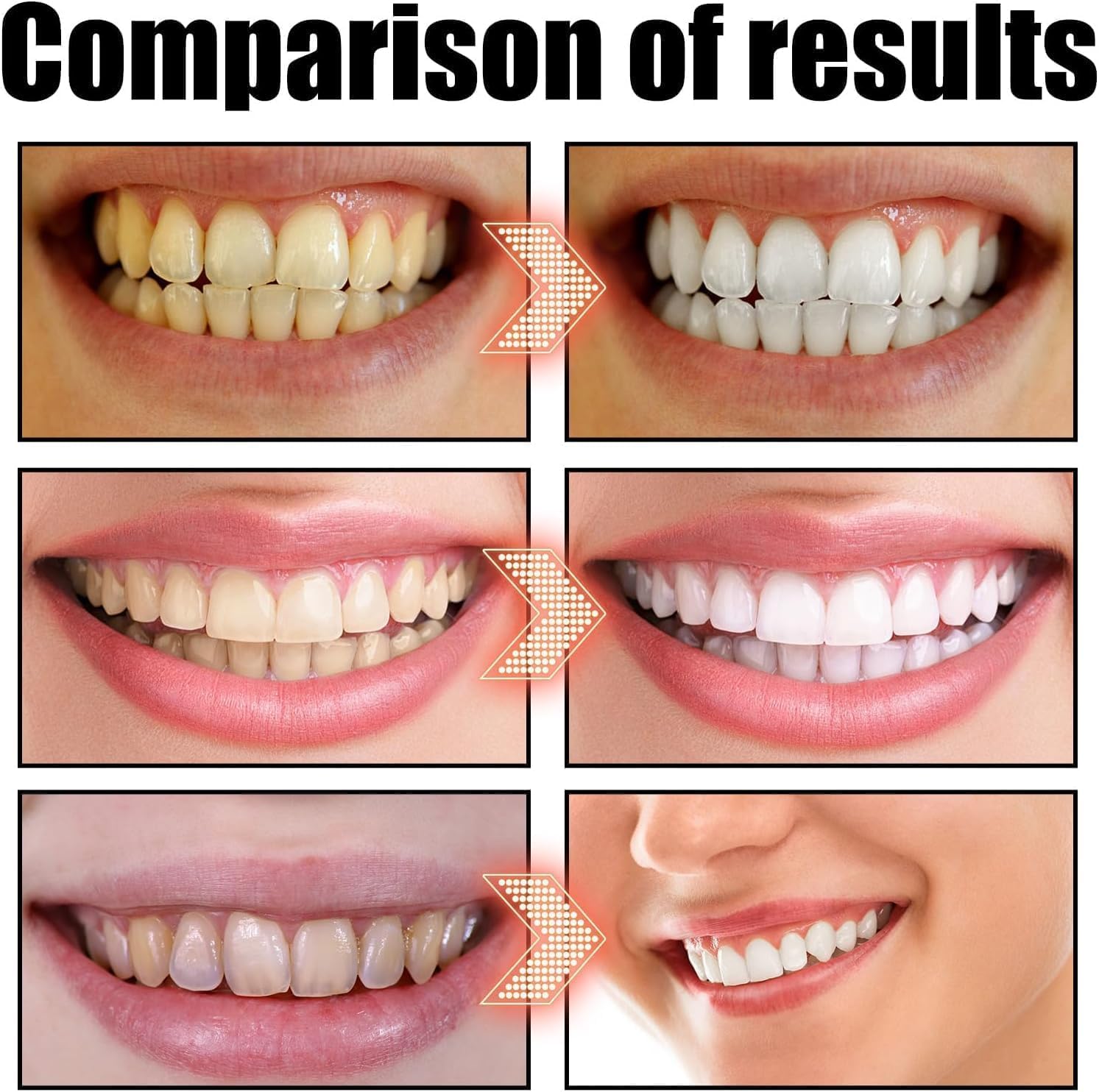 Spearmint Oil Pulling Mouthwash – Cold-Pressed Coconut Oil for Teeth Whitening, Fresh Breath & Oral Detox, 8oz