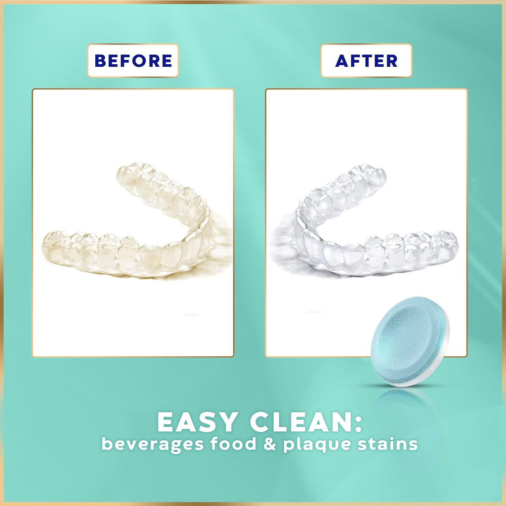 Retainer Cleaner Tablets - 48 Tablets (1.5 Months Supply) - Denture Cleaning, Removes Stains & Odours, Freshens Aligners, Mouthguards, Nightguards - Perfect for Ultrasonic Retainer Cleaner
