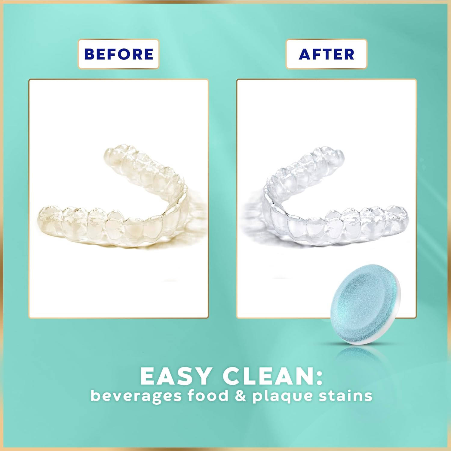 Retainer Cleaner Tablets - 48 Tablets (1.5 Months Supply) - Denture Cleaning, Removes Stains & Odours, Freshens Aligners, Mouthguards, Nightguards - Perfect for Ultrasonic Retainer Cleaner