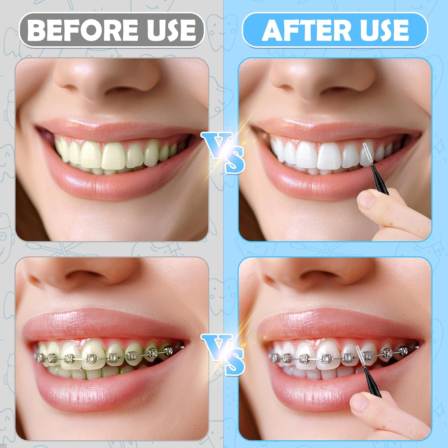 120Pcs Interdental Brushes, 360° Bendable Soft Bristles Braces Flossers Dental Brushes Between Teeth Gum Interdental Brushes for Gum Braces Oral Teeth Cleaning Tool （Black）