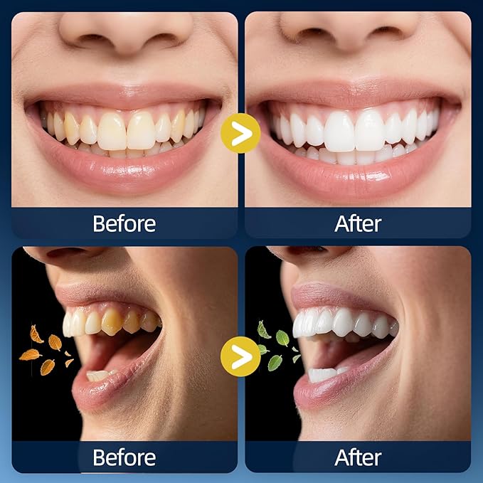 RAZOKO Mouthwash Travel Size-Portable Fresh Mint Packets,Alcohol & Fluoride Free Mouthwash,Disposable Oral Care Strips (0.41 Fl Oz (Pack of 30), Coconut)