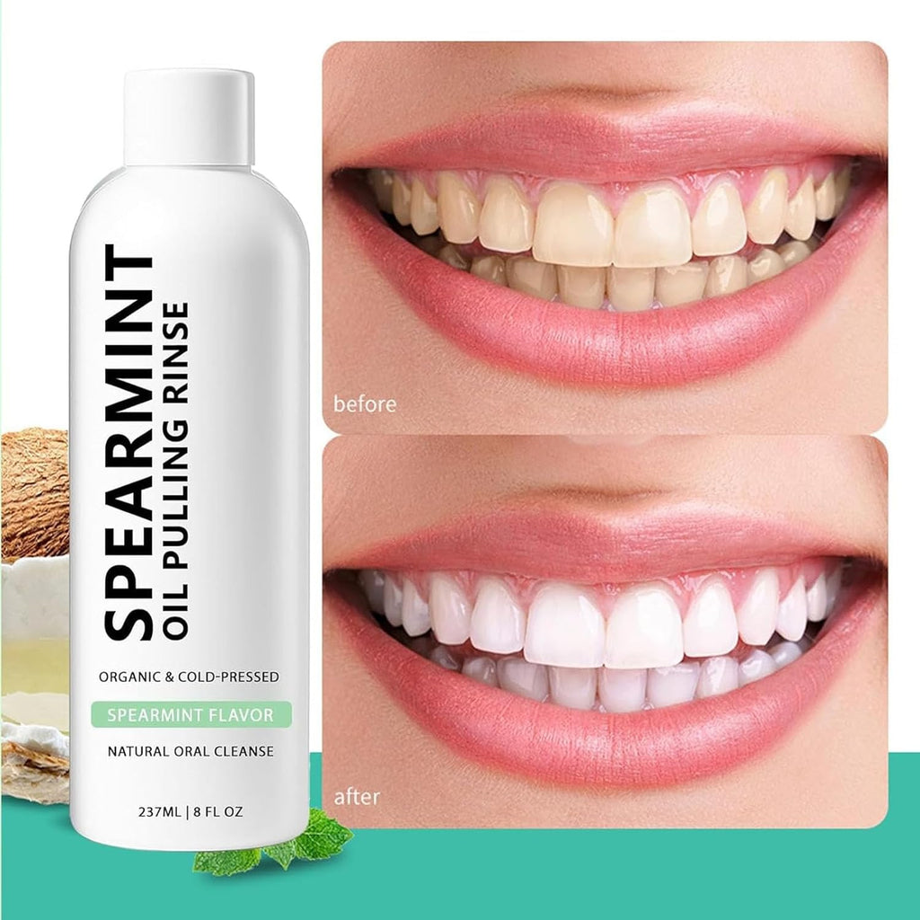 Spearmint Oil Pulling Rinse, Cold-Pressed Coconut Mouthwash for Teeth Whitening, Peppermint Oil for Teeth and Gums (1)