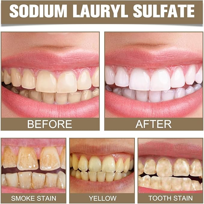 2Pcs Tooth Refresh Toothpaste, Fresh Breath Toothpaste, Natural Oral Care & Enamel Repair, Helps Remove Coffee, Tea & Wine Stains, Fresh Minty Gel