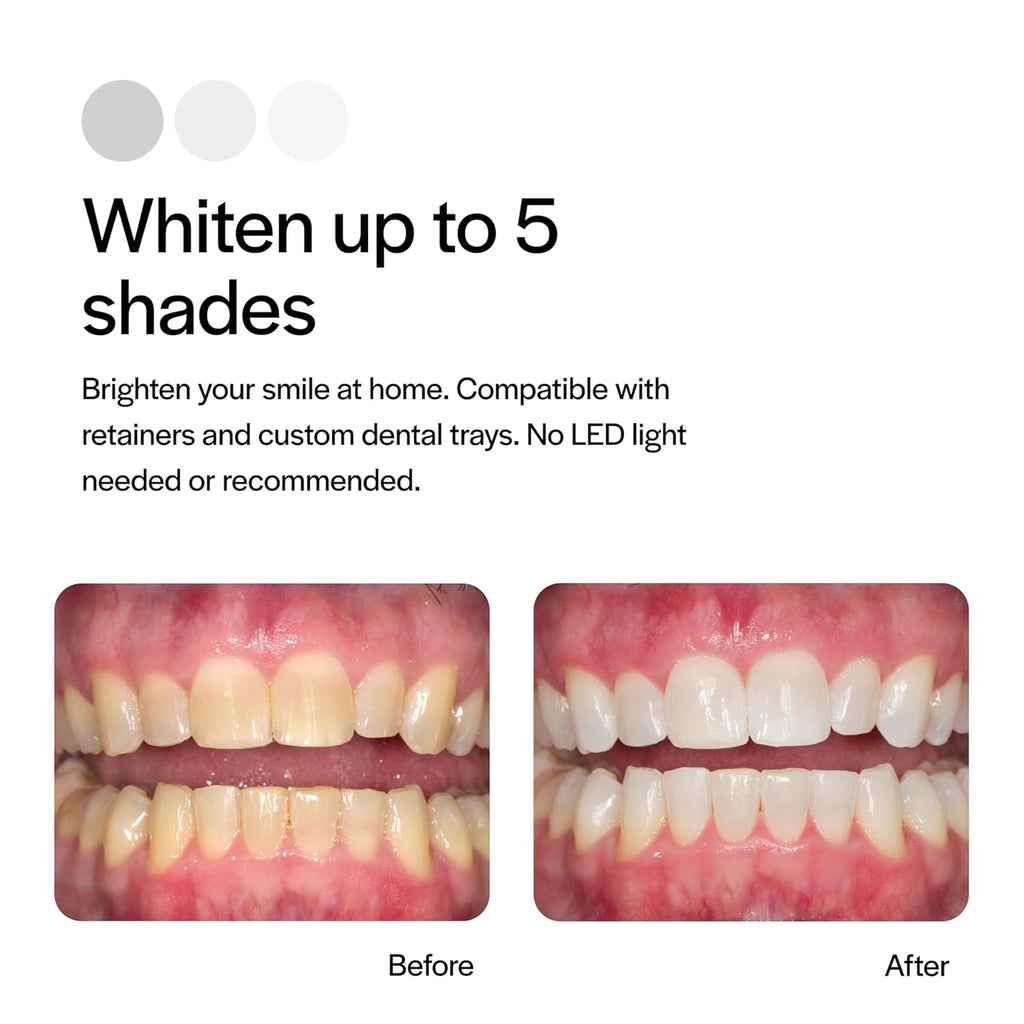 Opalescence 20% Gel Syringes Teeth Whitening - Refill Kit (12 Syringes) Carbamide Peroxide. Made by Ultradent, in Mint Flavor. Tooth Whitening - B-5196-6