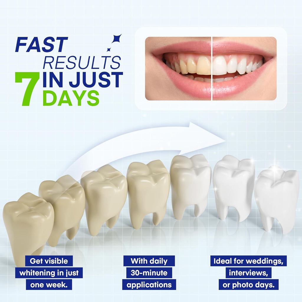 Teeth Whitening Pen – 35% Urea Peroxide Gel, Clear Twist-Dispensing Whitening Pens for Stain Removal, Professional-Strength, Easy-to-Use, Travel-Friendly(A Set of 5 Pens)