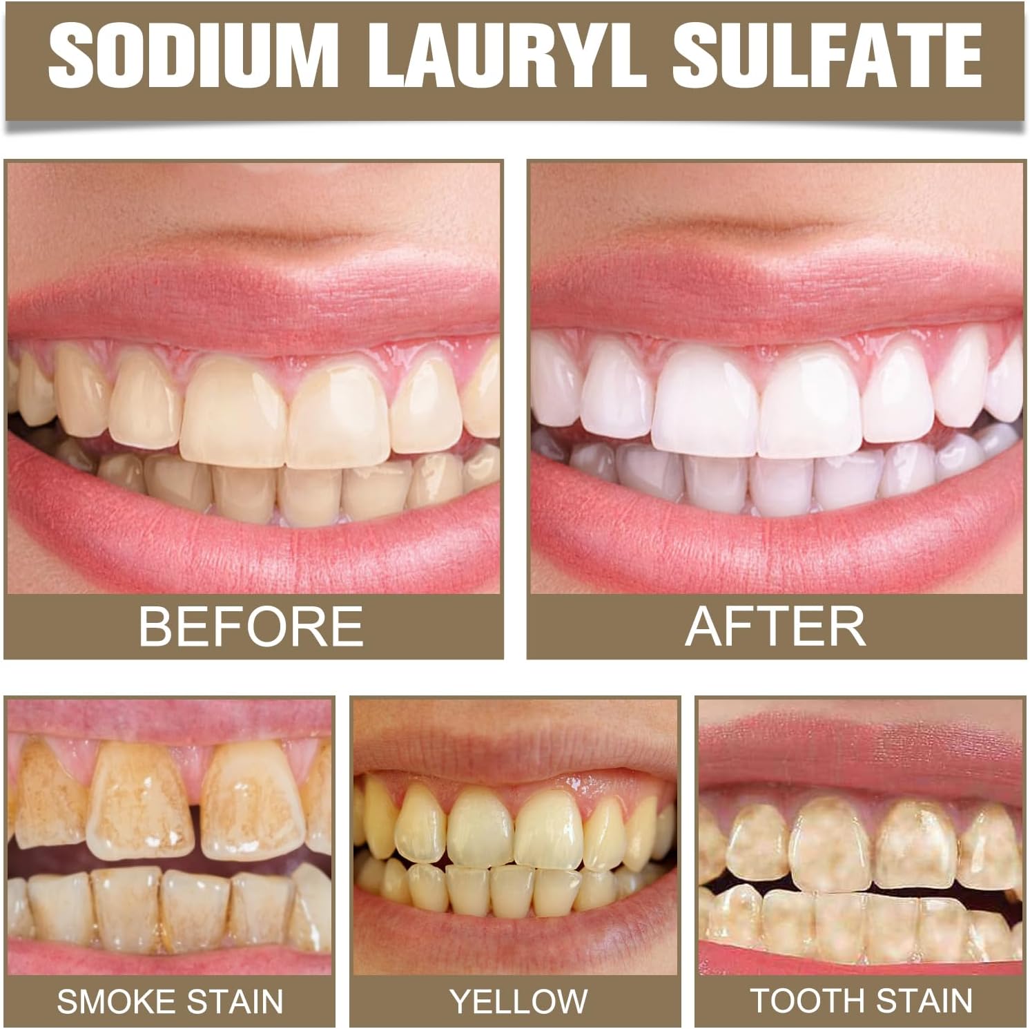 Tooth Refresh Toothpaste, Fresh Breath Toothpaste, Natural Oral Care & Enamel Repair, Helps Remove Coffee, Tea & Wine Stain(2PCS)