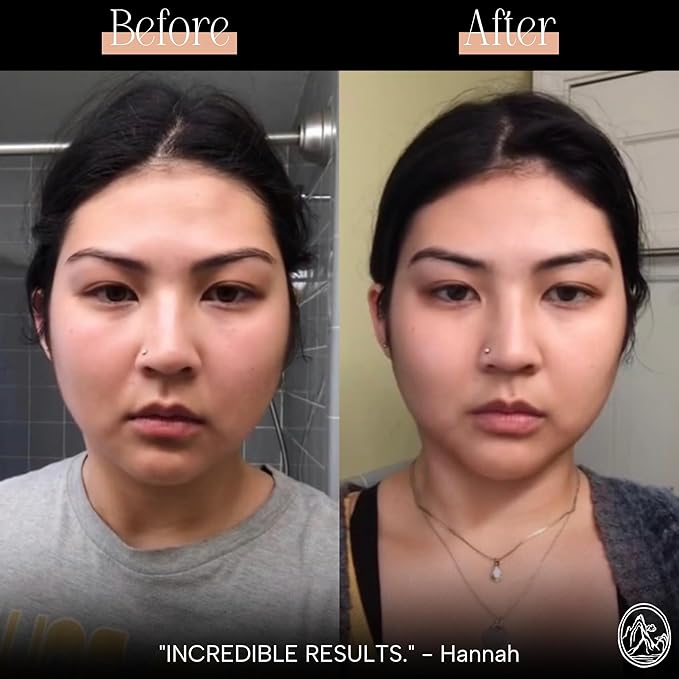 Mount Lai The Vitality Qi Stainless Steel Gua Sha Contour Tool - Face & Body Guasha Tools for Self-Care, Sculpting, Puffiness Relief & Muscle Tension Massage