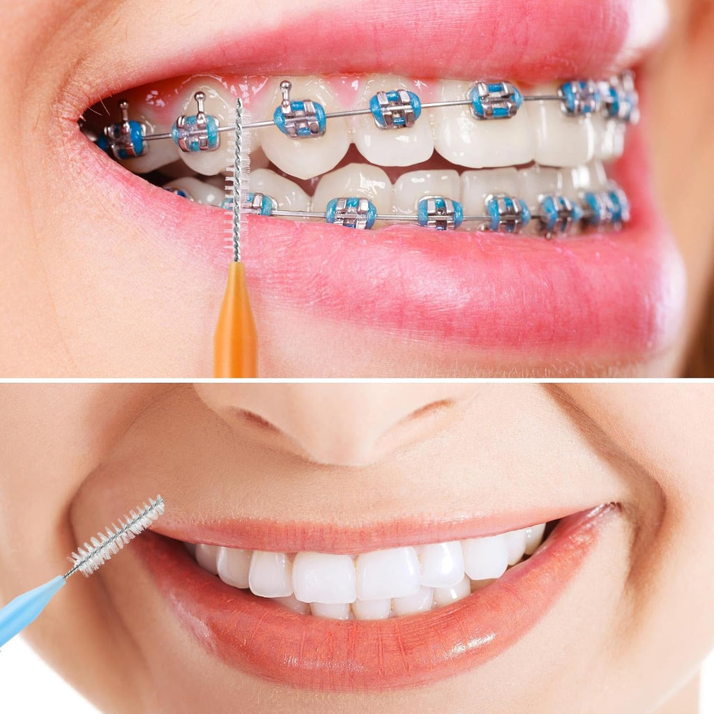 200Pcs Interdental Brushes Braces Toothbrush Teeth Gaps Cleaner Tools, 4 Color