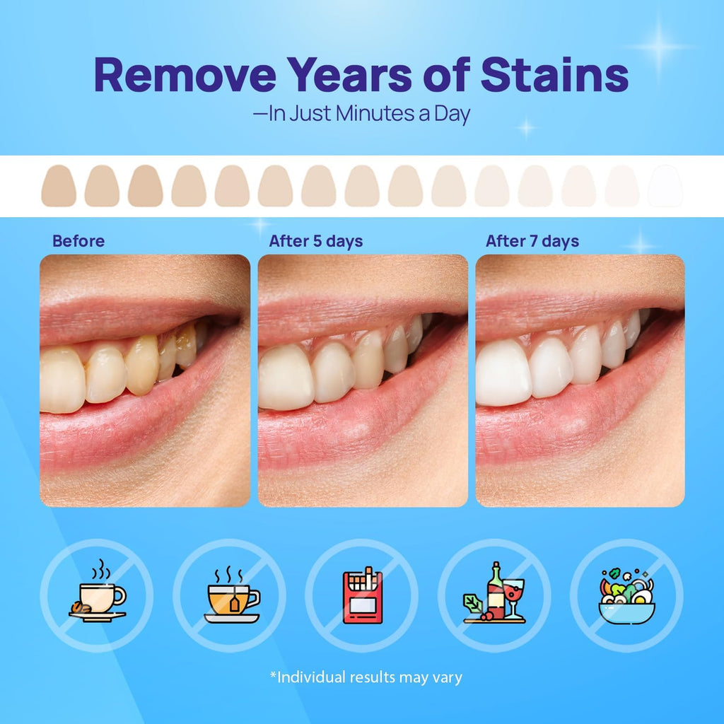 Whitebite Pro Upgraded Teeth Whitening Strips 14 Strips (7 Treatments) | Enamel-Safe | Deep Stains Removal | Non-Slip Design | Whitening Without Any Harm | Mint