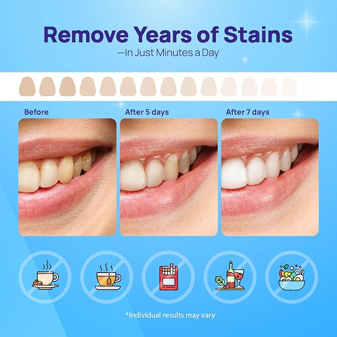 Whitebite Pro Teeth Whitening Strips with Hydrogen Peroxide – Dentist Grade, Enamel-Safe, Non-Slip, Removes Deep Stains, Reduces Sensitivity, Mint Flavor (14 Strips / 7 Treatments)