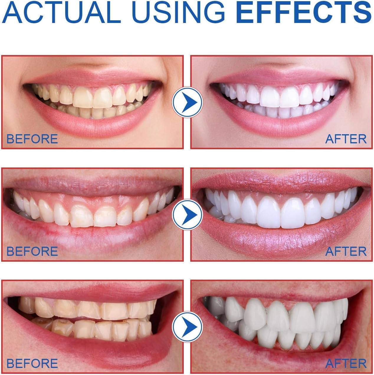 Niacinamide Whitening Toothpaste, Easilyous Radiant Whitening Toothpaste,Fresh Breath,Remove Tooth Stains, 2 Pack