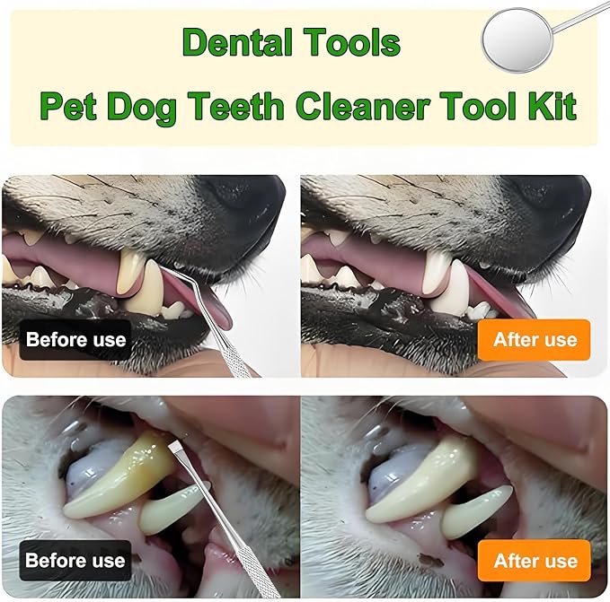 Teeth Cleaner Tool Kit Stainless Steel Plaque Tartar Remover Set of 6 with Metal Case, Tweezers, Oral Mirror, Teeth Cleaner, Probe, Stain Remover