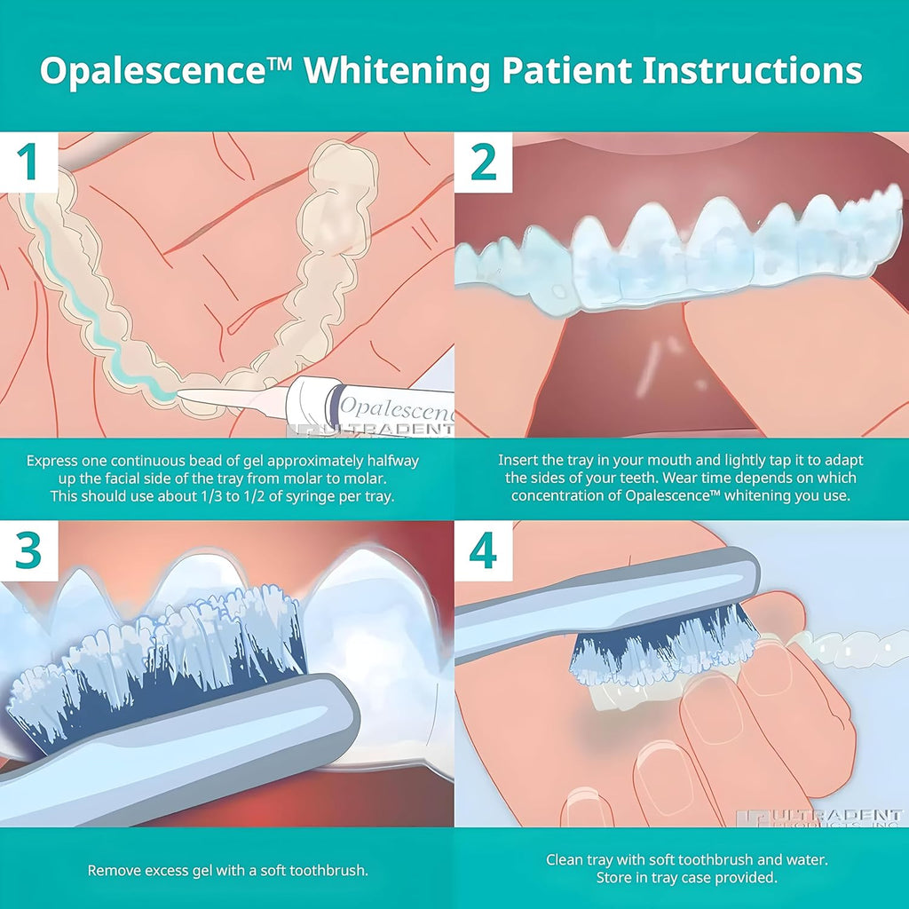 Opalescence 20% Teeth Whitening Refill Kit (4 Syringes) Carbamide Peroxide. Made by Ultradent, in Mint Flavor. Tooth Whitening Refill Syringes - B-5196-4