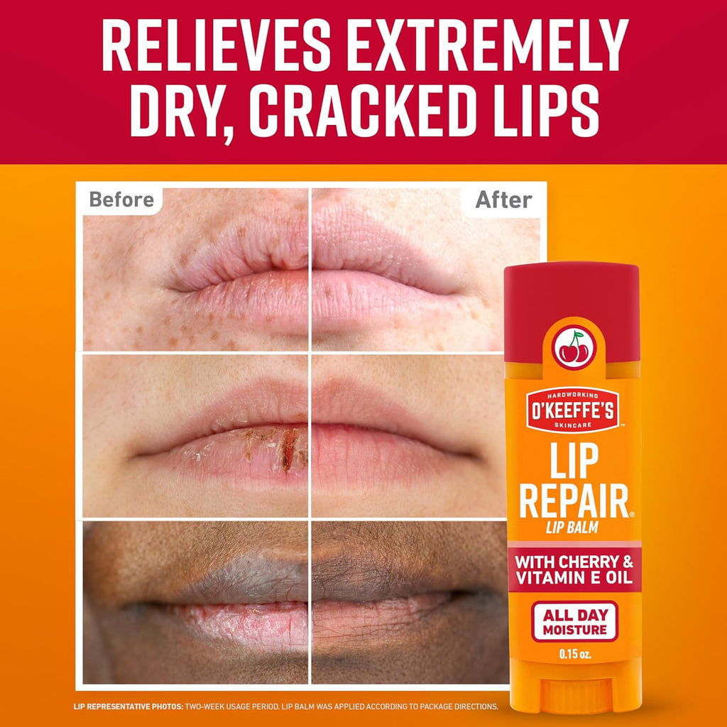 O'Keeffe's Lip Repair Lip Balm with Cherry & Vitamin E Oil - Stick (3 Pack) - Moisturizer for Extremely Cracked, Dry Lips