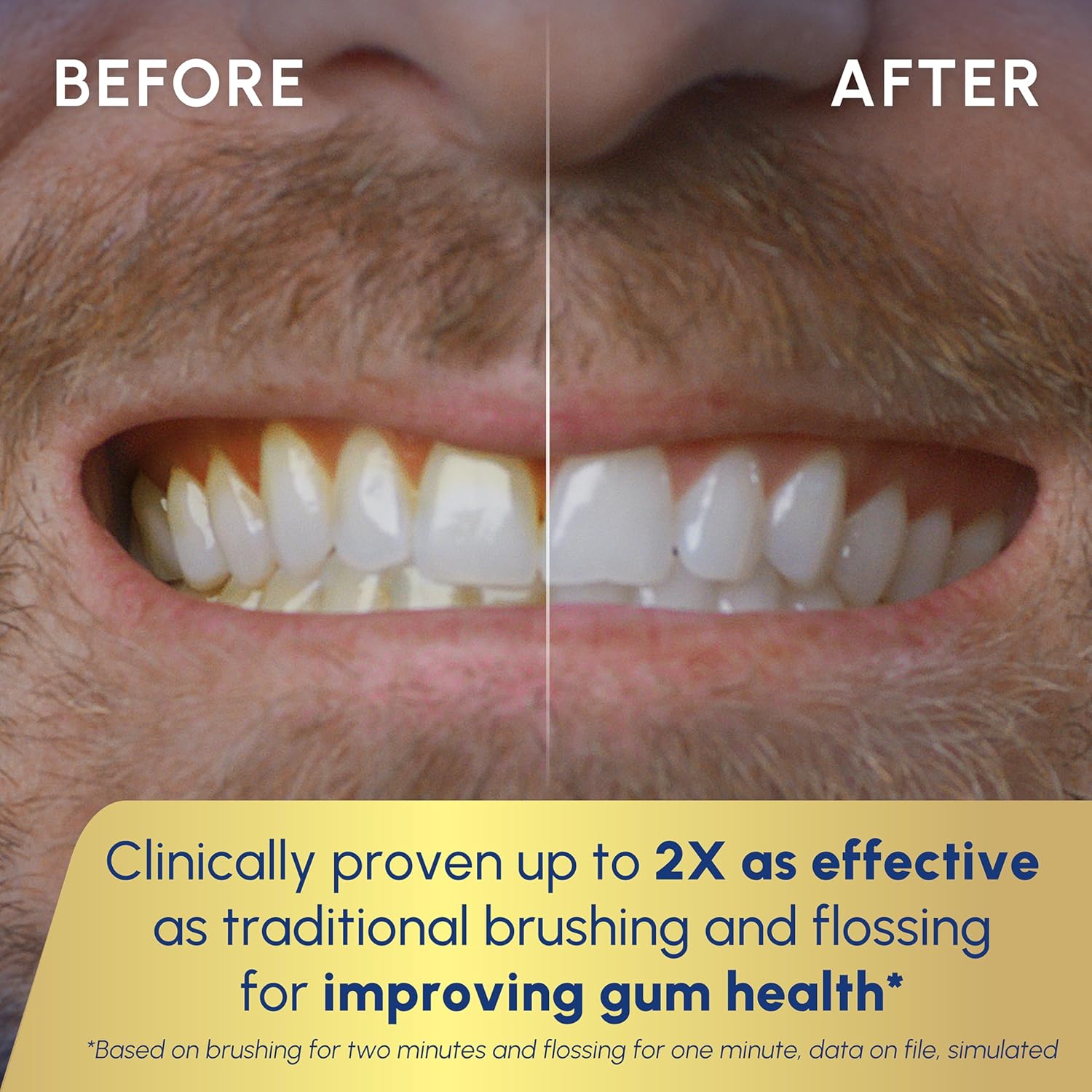 Waterpik Sonic-Fusion 2.0 Professional Flossing Electric Toothbrush with Water Flosser Combo In One, Black SF-04, Packaging May Vary