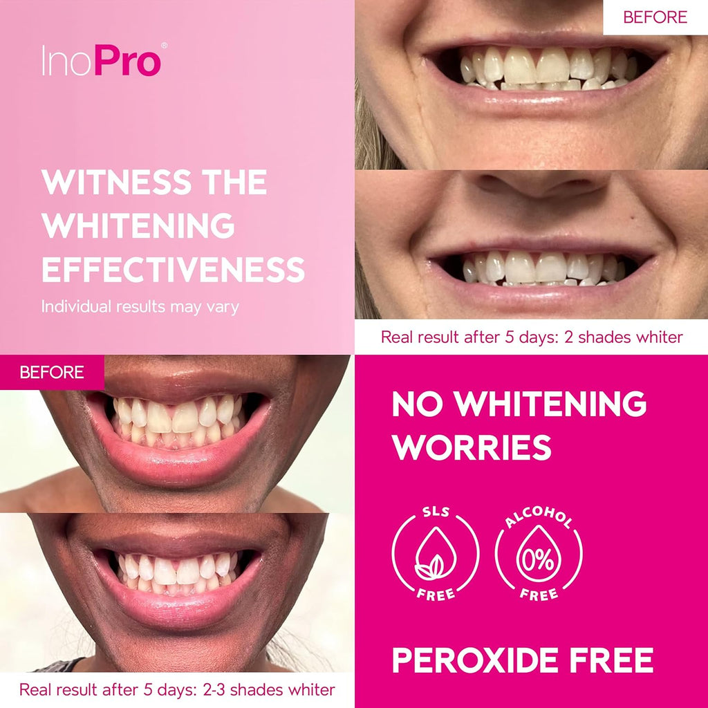 InoPro Teeth Whitening Strips 14 Treatments Kit - Teeth Whitener, Peroxide Free, Green White Strips for Teeth Whitening with Arbutin, Coconut Oil, Deep Stains Removal (28 Strips)